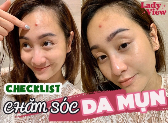 CHECKLIST CHĂM SÓC DA MỤN KHÔNG THỂ BỎ QUA