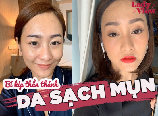 BỎ TÚI 4 BÍ KÍP THẦN THÁNH GIÚP DA SẠCH MỤN - 